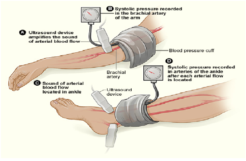 automatic-leg-dopplers-the-academy-of-research-and-improvement