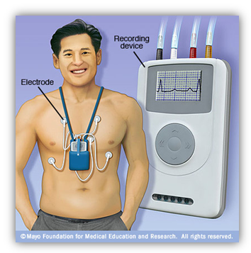 Holter Monitor – SAAT Healthcare